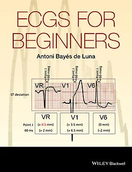 E-Book (pdf) ECGs for Beginners von Antoni Bayés de Luna