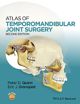 E-Book (pdf) Atlas of Temporomandibular Joint Surgery von 