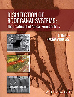 eBook (pdf) Disinfection of Root Canal Systems de 