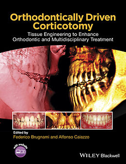 E-Book (epub) Orthodontically Driven Corticotomy von 