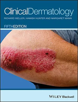 E-Book (pdf) Clinical Dermatology von Richard B. Weller, Hamish J. A. Hunter, Margaret W. Mann