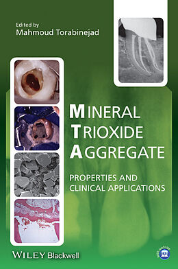 E-Book (pdf) Mineral Trioxide Aggregate von Mahmoud Torabinejad
