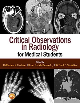 E-Book (pdf) Critical Observations in Radiology for Medical Students von Katherine R. Birchard, Kiran Reddy Busireddy, Richard C. Semelka