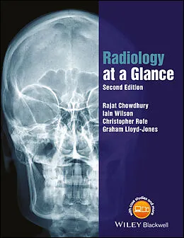 E-Book (epub) Radiology at a Glance von Rajat Chowdhury, Iain Wilson, Christopher Rofe