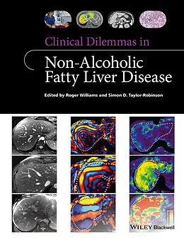 E-Book (pdf) Clinical Dilemmas in Non-Alcoholic Fatty Liver Disease von Roger Williams, Simon D. Taylor-Robinson