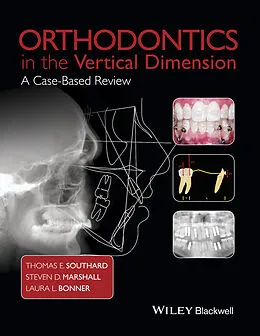 E-Book (epub) Orthodontics in the Vertical Dimension von Thomas E. Southard, Steven D. Marshall, Laura L. Bonner