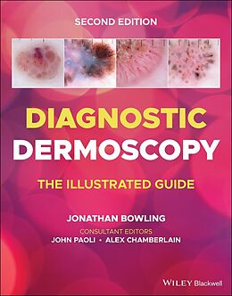 eBook (epub) Diagnostic Dermoscopy de 