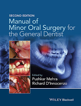 eBook (epub) Manual of Minor Oral Surgery for the General Dentist de Pushkar Mehra, Richard D'Innocenzo
