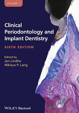 E-Book (pdf) Clinical Periodontology and Implant Dentistry, 2 Volume Set von 