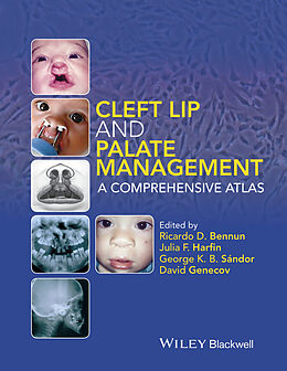 eBook (epub) Cleft Lip and Palate Management de George K. B. Sándor, David Genecov