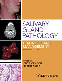 E-Book (pdf) Salivary Gland Pathology von Eric Carlson, Robert A. Ord