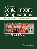 E-Book (pdf) Dental Implant Complications von 