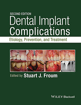 E-Book (pdf) Dental Implant Complications von 