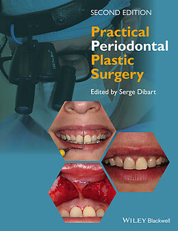 E-Book (pdf) Practical Periodontal Plastic Surgery von 