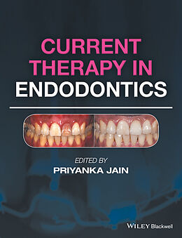 E-Book (pdf) Current Therapy in Endodontics von 