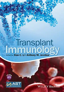 E-Book (pdf) Transplant Immunology von Xian C. Li, Anthony M. Jevnikar