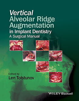 E-Book (epub) Vertical Alveolar Ridge Augmentation in Implant Dentistry von Len Tolstunov