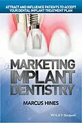 E-Book (epub) Marketing Implant Dentistry von Marcus Hines