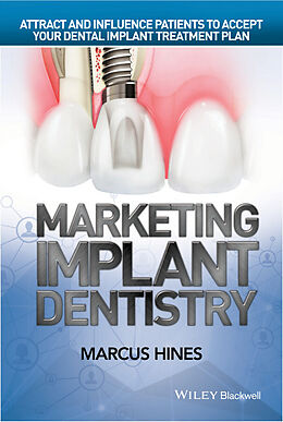 eBook (pdf) Marketing Implant Dentistry de Marcus Hines