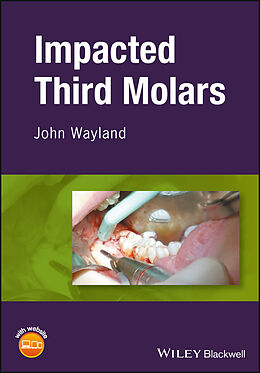 eBook (pdf) Impacted Third Molars de John Wayland