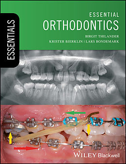 eBook (epub) Essential Orthodontics de Birgit Thilander, Krister Bjerklin, Lars Bondemark