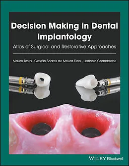 E-Book (pdf) Decision Making in Dental Implantology von Mauro Tosta, Gastão Soares de Moura Filho, Leandro Chambrone