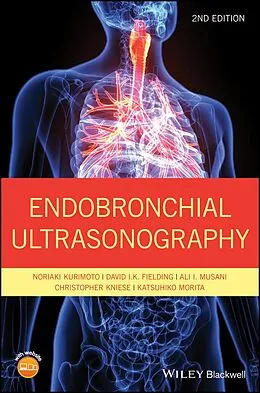 E-Book (pdf) Endobronchial Ultrasonography von Noriaki Kurimoto, David I. K. Fielding, Ali I. Musani