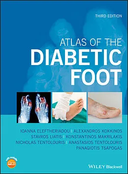 E-Book (pdf) Atlas of the Diabetic Foot von Ioanna Eleftheriadou, Alexandros Kokkinos, Stavros Liatis