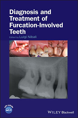 E-Book (pdf) Diagnosis and Treatment of Furcation-Involved Teeth von 