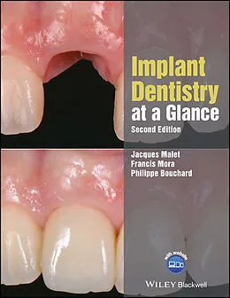 E-Book (epub) Implant Dentistry at a Glance von Jacques Malet, Francis Mora, Philippe Bouchard