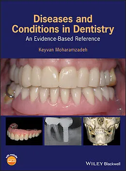 E-Book (epub) Diseases and Conditions in Dentistry von Keyvan Moharamzadeh