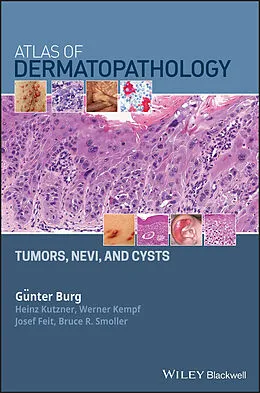 E-Book (pdf) Atlas of Dermatopathology von Günter Burg, Heinz Kutzner, Werner Kempf