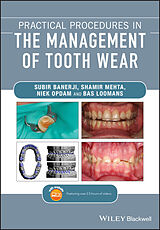 eBook (epub) Practical Procedures in the Management of Tooth Wear de Subir Banerji, Shamir B. Mehta, Niek Opdam