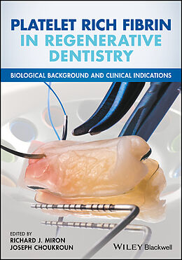 E-Book (epub) Platelet Rich Fibrin in Regenerative Dentistry von 