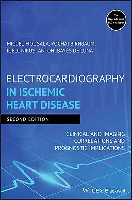 E-Book (pdf) Electrocardiography in Ischemic Heart Disease von Miquel Fiol-Sala, Yochai Birnbaum, Kjell Nikus