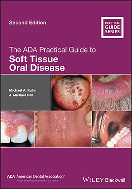 E-Book (pdf) The ADA Practical Guide to Soft Tissue Oral Disease von Michael A. Kahn, J. Michael Hall