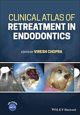 eBook (epub) Clinical Atlas of Retreatment in Endodontics de 