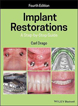 eBook (epub) Implant Restorations de Carl Drago