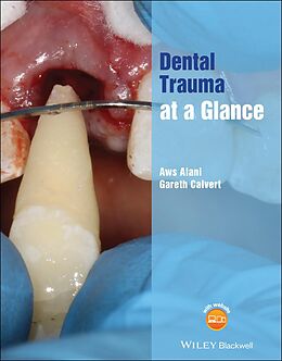 E-Book (pdf) Dental Trauma at a Glance von Aws Alani, Gareth Calvert
