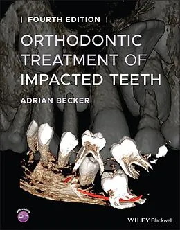 E-Book (pdf) Orthodontic Treatment of Impacted Teeth von Adrian Becker