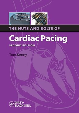 E-Book (pdf) The Nuts and Bolts of Cardiac Pacing von Tom Kenny
