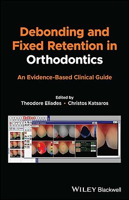 eBook (epub) Debonding and Fixed Retention in Orthodontics de 