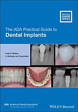 eBook (pdf) The ADA Practical Guide to Dental Implants de Luigi O. Massa, J. Anthony von Fraunhofer