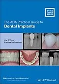 E-Book (epub) The ADA Practical Guide to Dental Implants von Luigi O. Massa, J. Anthony von Fraunhofer