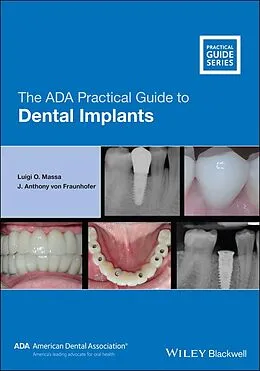 E-Book (epub) The ADA Practical Guide to Dental Implants von Luigi O. Massa, J. Anthony von Fraunhofer