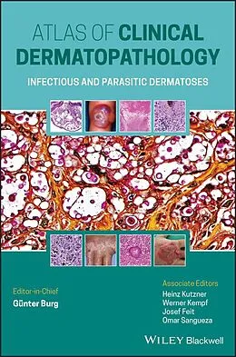 E-Book (epub) Atlas of Clinical Dermatopathology von Günter Burg, Werner Kempf, Heinz Kutzner