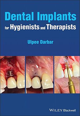 eBook (pdf) Dental Implants for Hygienists and Therapists de Ulpee R. Darbar