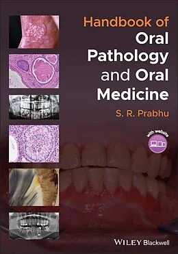 E-Book (pdf) Handbook of Oral Pathology and Oral Medicine von S. R. Prabhu