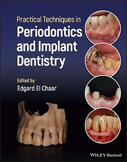 eBook (pdf) Practical Techniques in Periodontics and Implant Dentistry de 