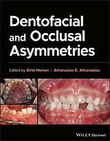Fester Einband Dentofacial and Occlusal Asymmetries von Birte (Royal Dental College, Univerity of Melsen